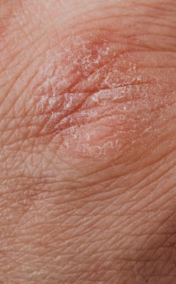 Diagnostic dermatologique - dermato_fc