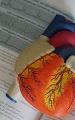 ECG - ecg_fc
